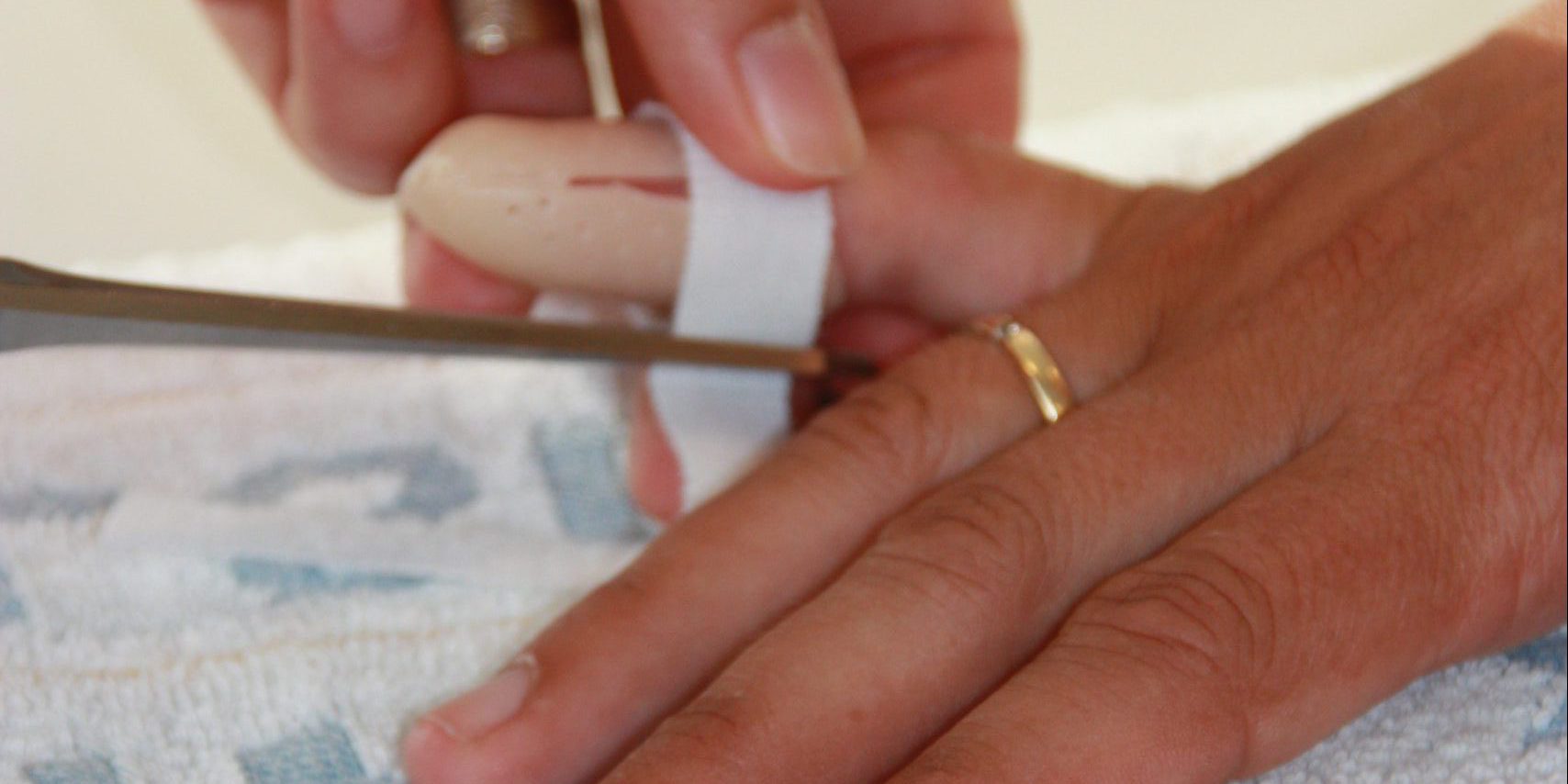 Aanleggen spalkje – Hand & Pols Centrum